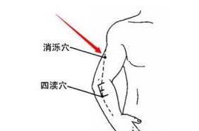 消泺穴