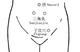 三角灸穴