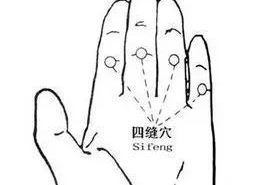 四缝穴