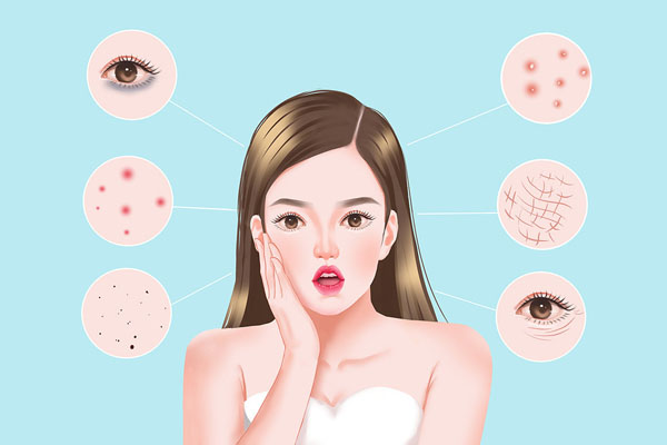 额头长痘是什么原因 额头长痘该怎么护理