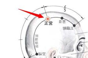 正营穴