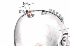 通天穴