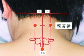 颈百劳穴