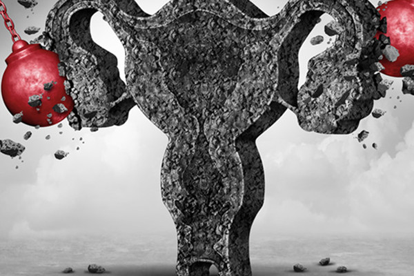 上环对身体的危害有哪些 女性上环对身体的危害