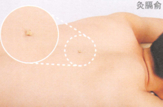 呃逆艾灸哪个部位图解