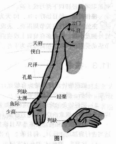 肩关节周围炎磁圆梅针疗法