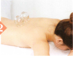 胆结石拔罐部位图解