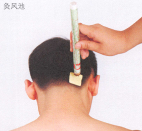 眩晕艾灸哪个部位图解