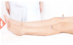 消化性溃疡拔罐部位图解