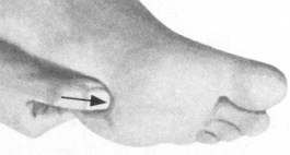 冠心病按摩部位图解