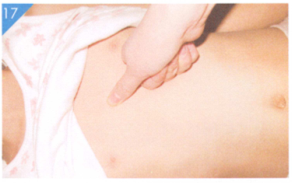 小儿百日咳按摩部位图解