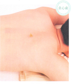 冠心病艾灸哪个部位图解