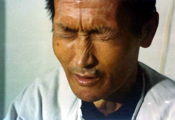 中医望色之病色青黄