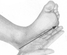 腰椎间盘突出症按摩部位图解