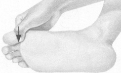 颈背痛按摩部位图解