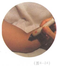 中风艾灸哪个部位图解