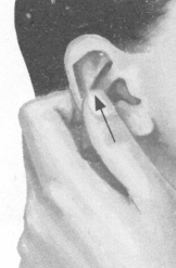 颈椎病按摩部位图解