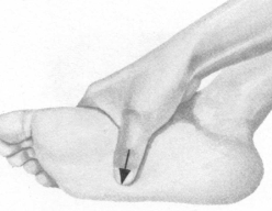 便秘按摩部位图解