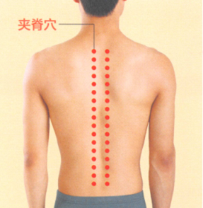 强直性脊柱炎艾灸哪个部位图解