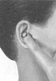 糖尿病按摩部位图解