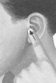 肥胖症按摩部位图解