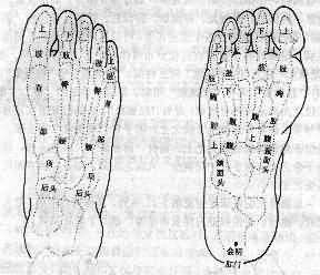 足象针