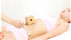 反流性食管炎艾灸哪个部位图解