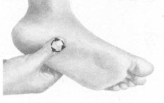 糖尿病按摩部位图解