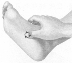 前列腺疾病按摩部位图解