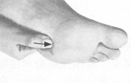 咳喘病按摩部位图解