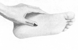 糖尿病按摩部位图解