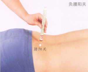 慢性腰肌劳损艾灸哪个部位图解