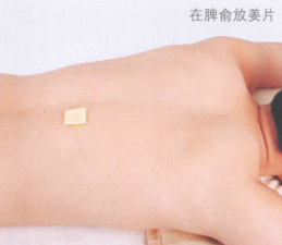 斑秃艾灸哪个部位图解