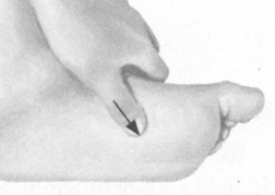 更年期综合征按摩部位图解