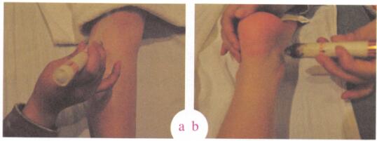 关节疼痛艾灸哪个部位图解