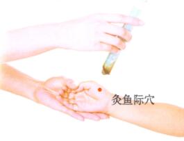 百日咳刮痧部位图解