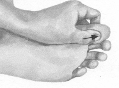 前列腺疾病按摩部位图解