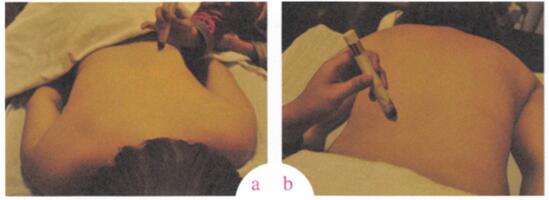 低血压艾灸哪个部位图解