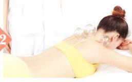 玫瑰糠疹拔罐部位图解