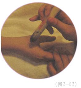 防治酒槽鼻艾灸哪个部位图解