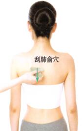 雀斑刮痧部位图解