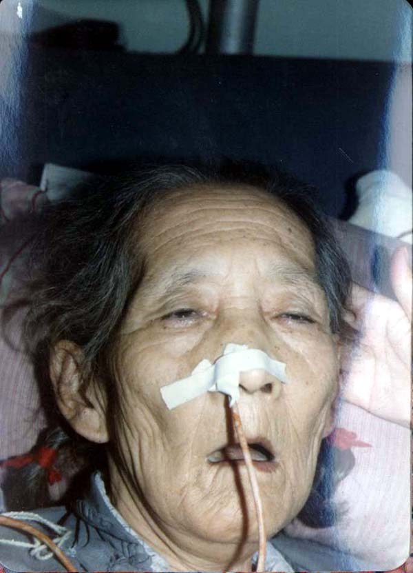 中医望神之目暗睛迷无神