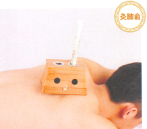 鼻炎艾灸哪个部位图解