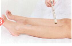 痤疮艾灸哪个部位图解