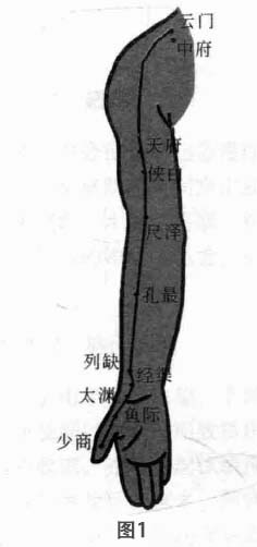 肱骨外上髁炎磁圆梅针疗法