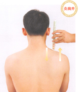 颈椎病艾灸哪个部位图解