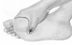 腹泻按摩部位图解