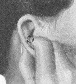 鼻炎按摩部位图解