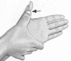 更年期综合征按摩部位图解