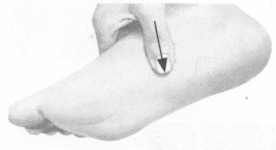 风湿病按摩部位图解